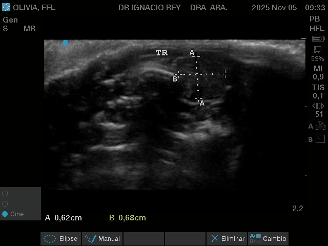 Ecografía Cervical Veterinaria
